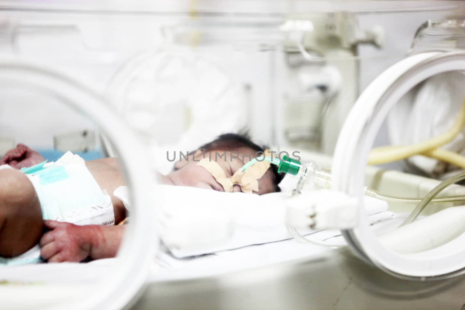 Newborn baby inside incubator