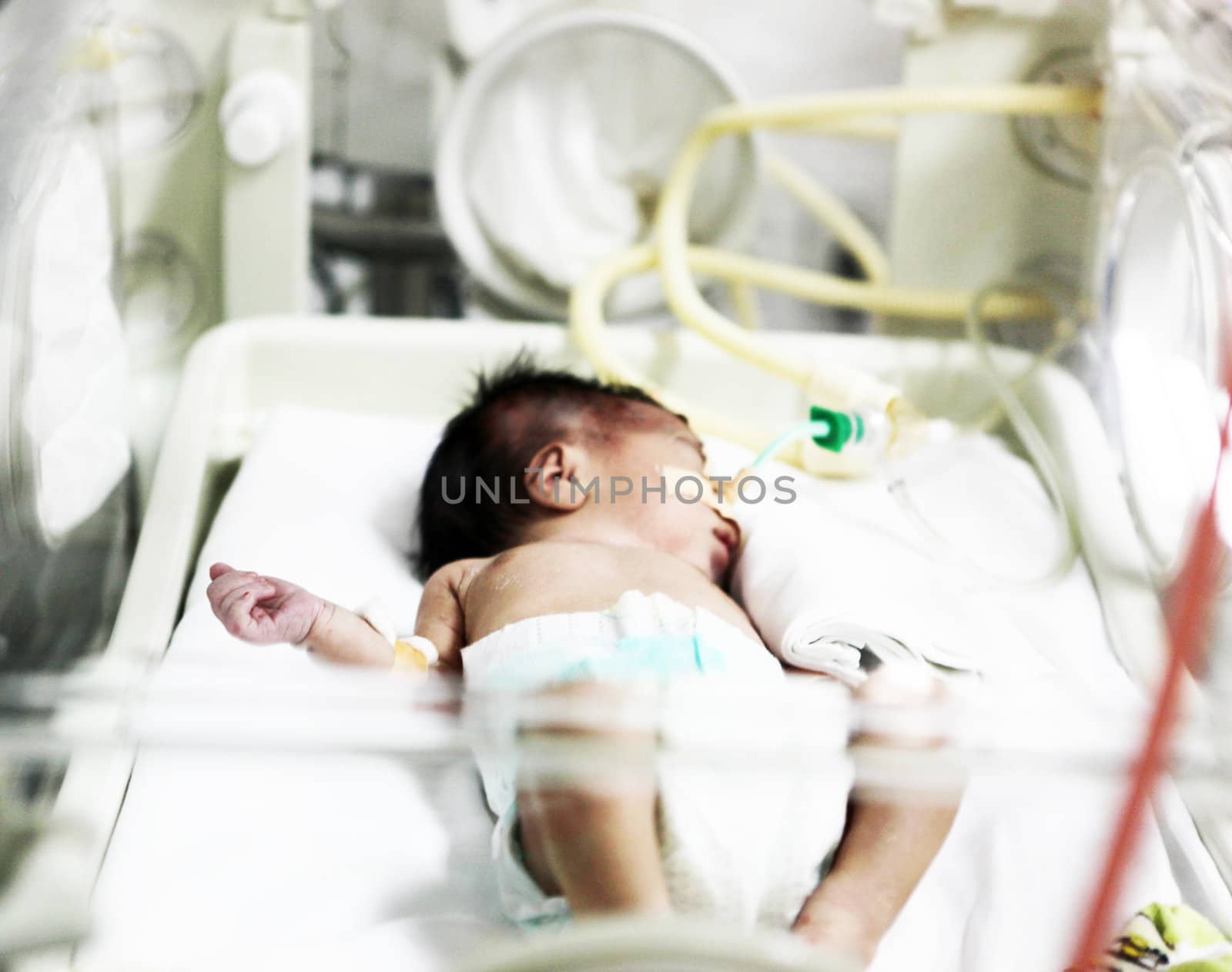 Newborn baby inside incubator