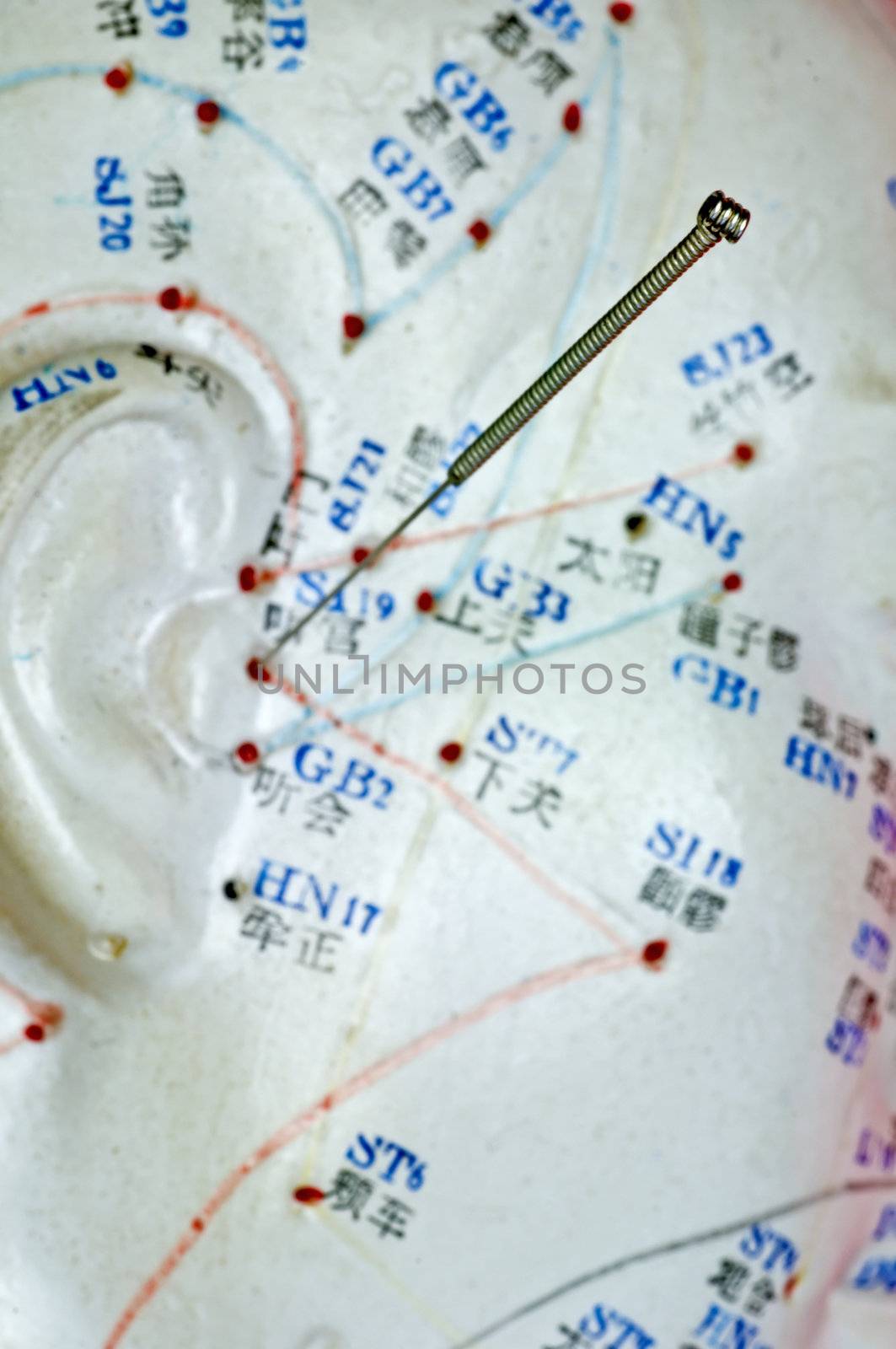 Acupuncture needle on head model by Jochen