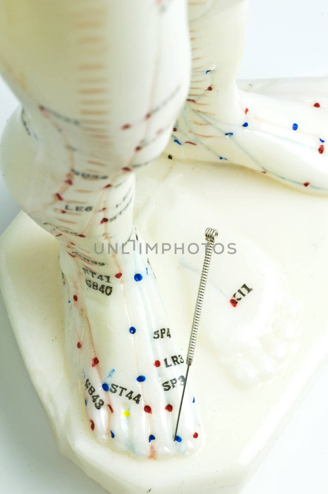 acupuncture demonstration on model