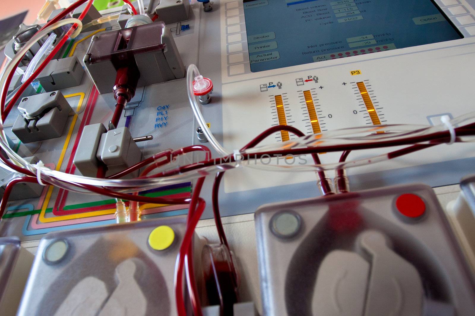 Cell saver device for blood reinfusion, stem cells transplantation
