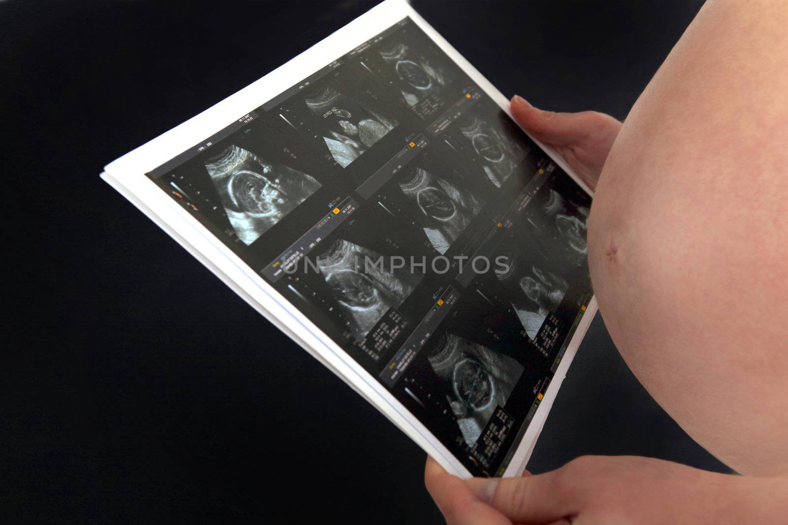 A pregnant woman looking at her echography. by phovoir