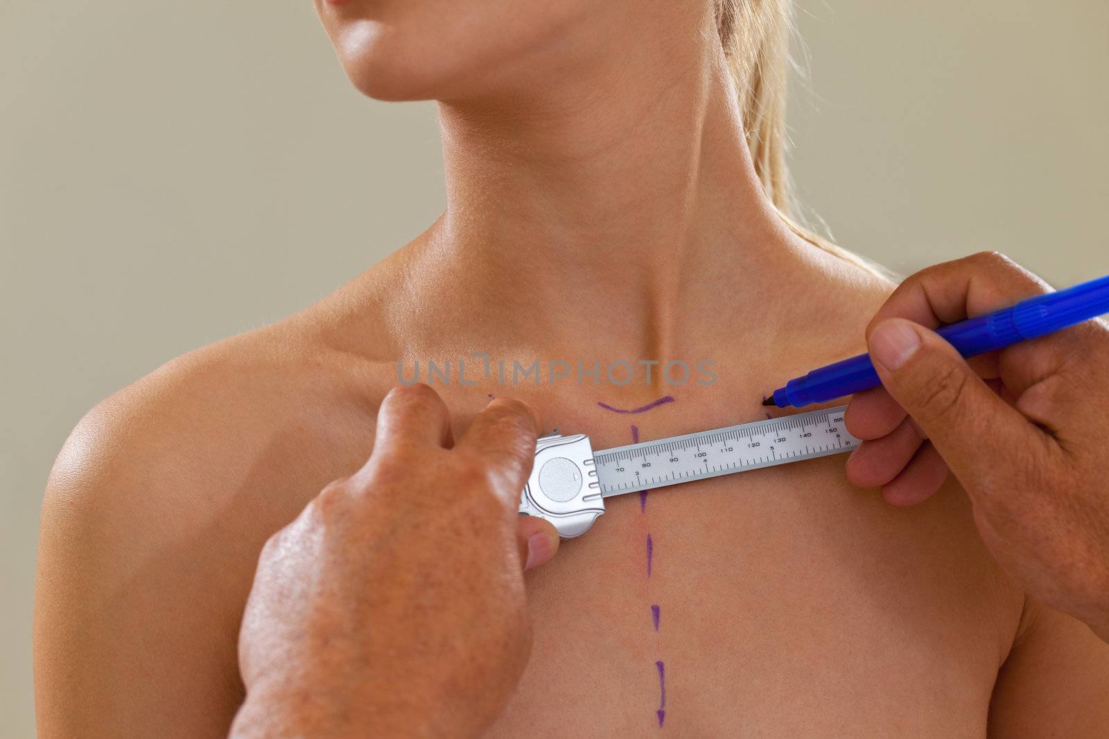 Close-up of topless female patient being prepared for plastic surgery