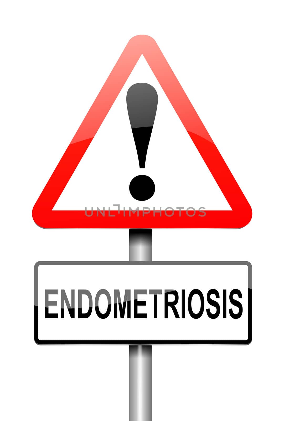 Illustration depicting a sign with an Endometriosis concept.