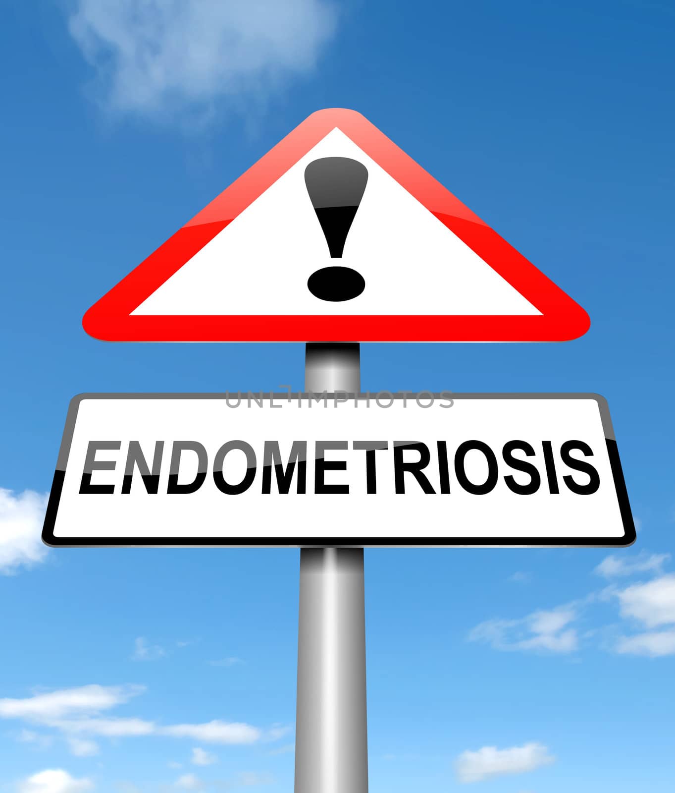 Illustration depicting a sign with an Endometriosis concept.