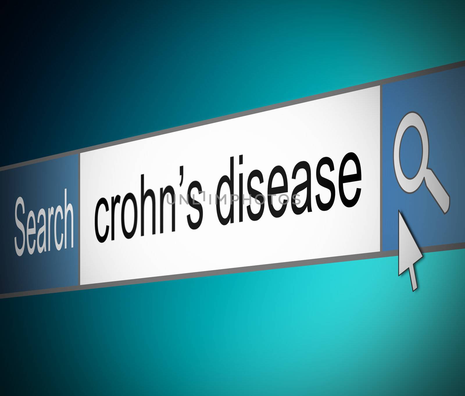 Illustration depicting a screen shot of an internet search bar containing a Crohn's Disease concept.