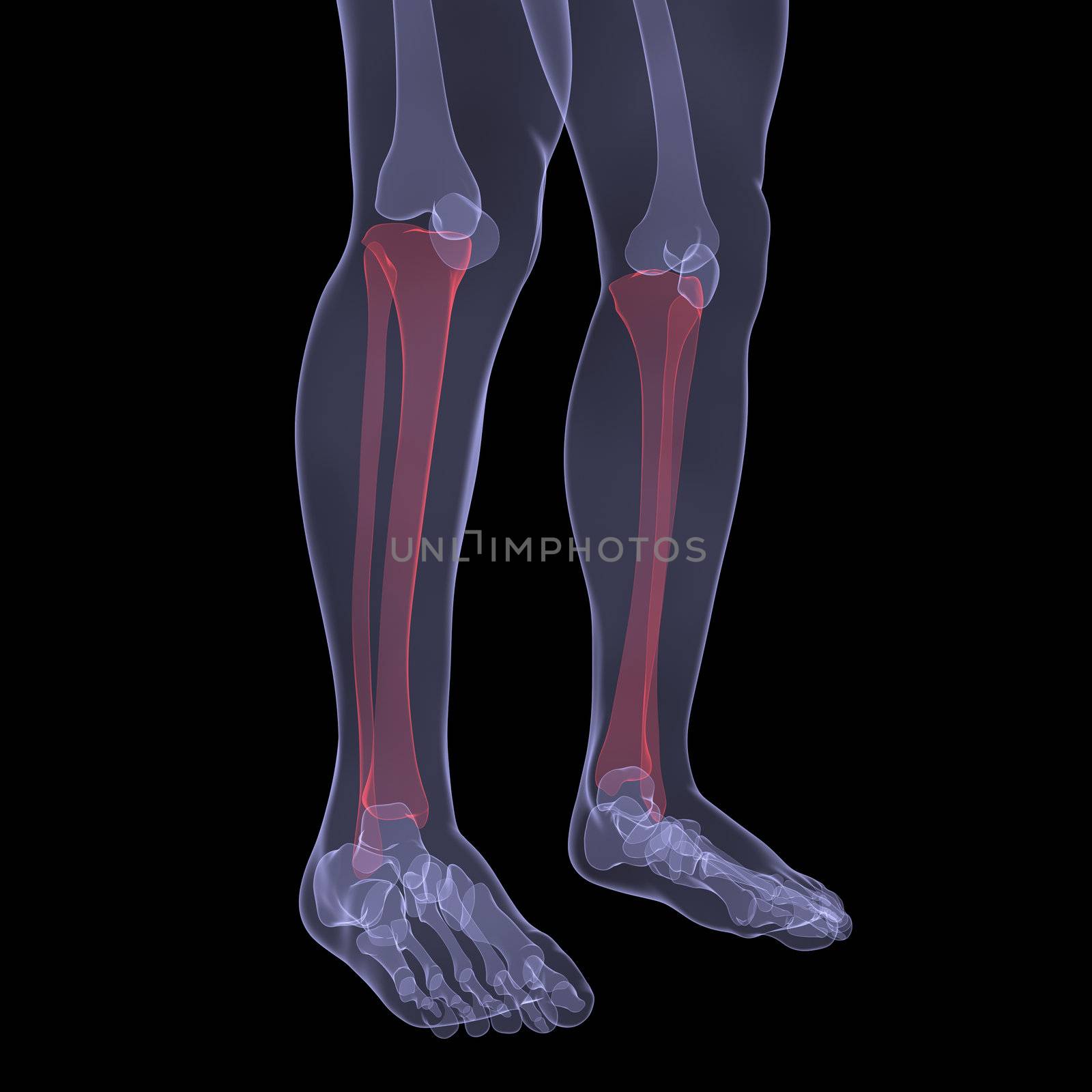 X-ray of human legs. Render on a black background