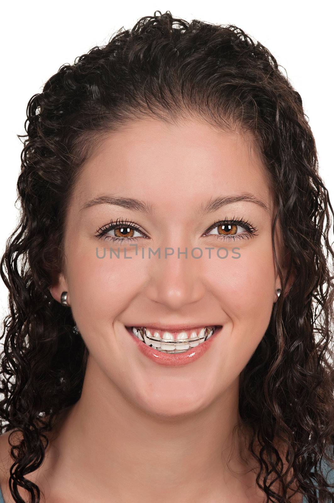 Girl with dental braces ( retainer)
