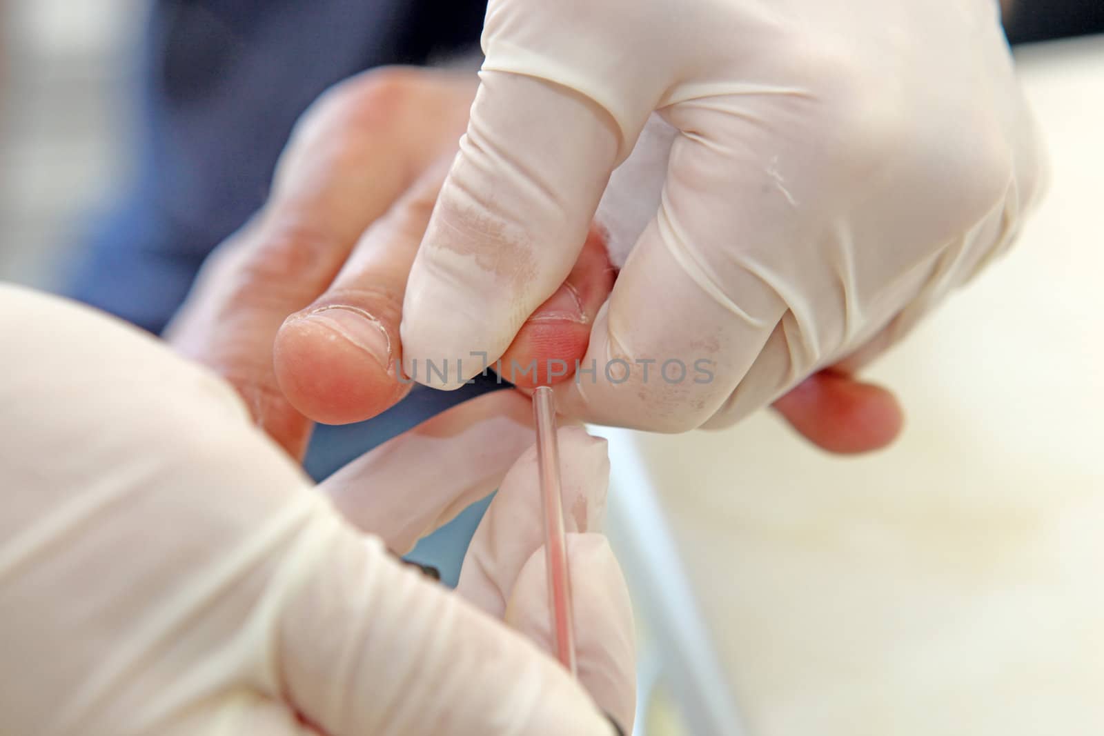 Blood Test