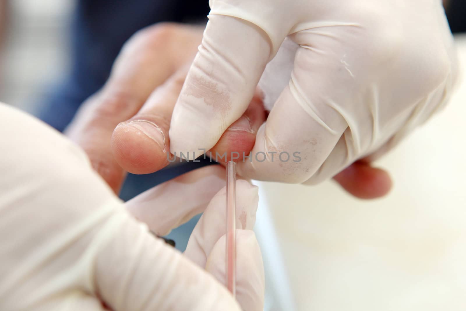 Blood Test