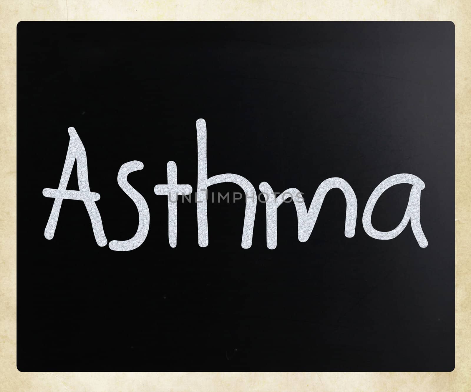 Asthma
