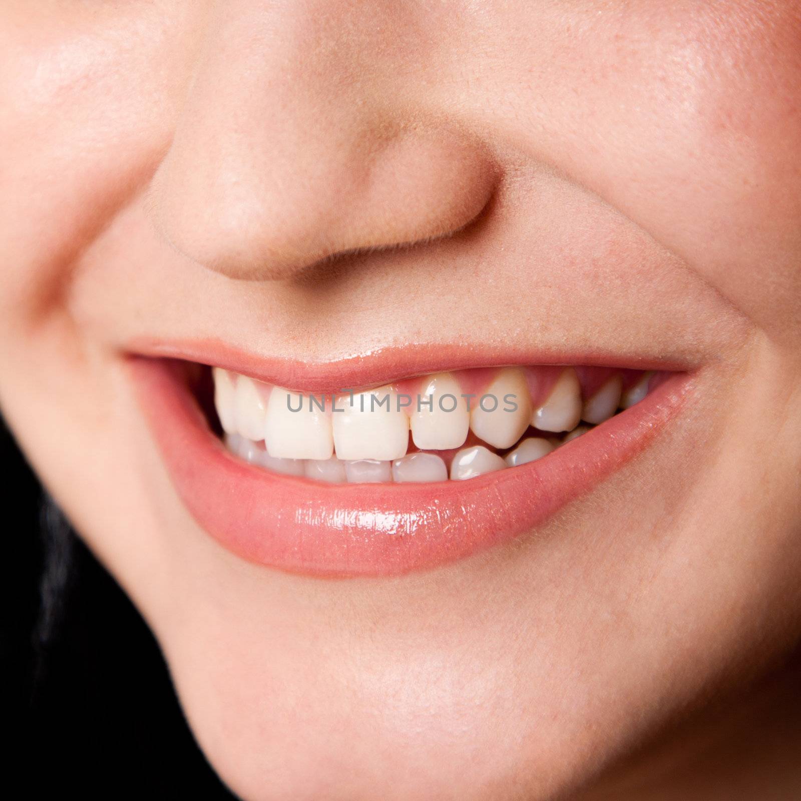 Beautiful white teeth in a perfect happy smile of a female face, dentist tooth whitening concept.