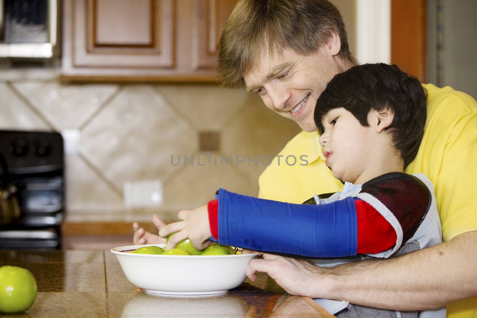 Father helping disabled son putting fruit into bowl in the kitchen. Son has cerebral palsy.