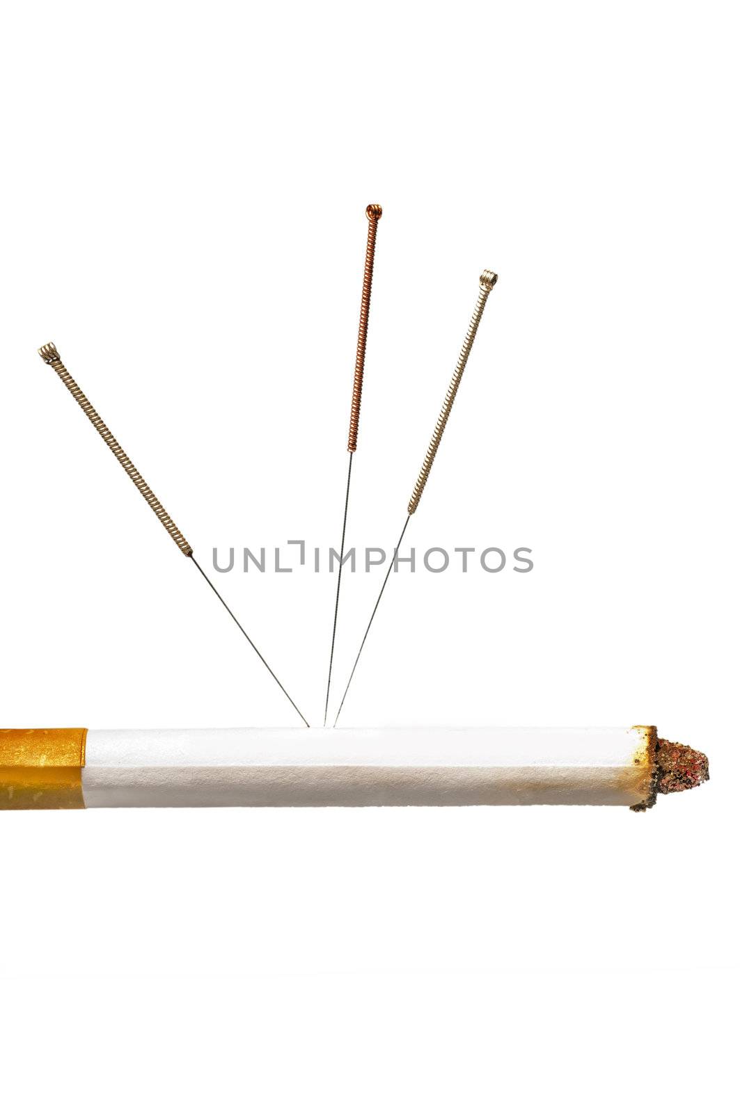 acupuncture to stop smoking by Jochen
