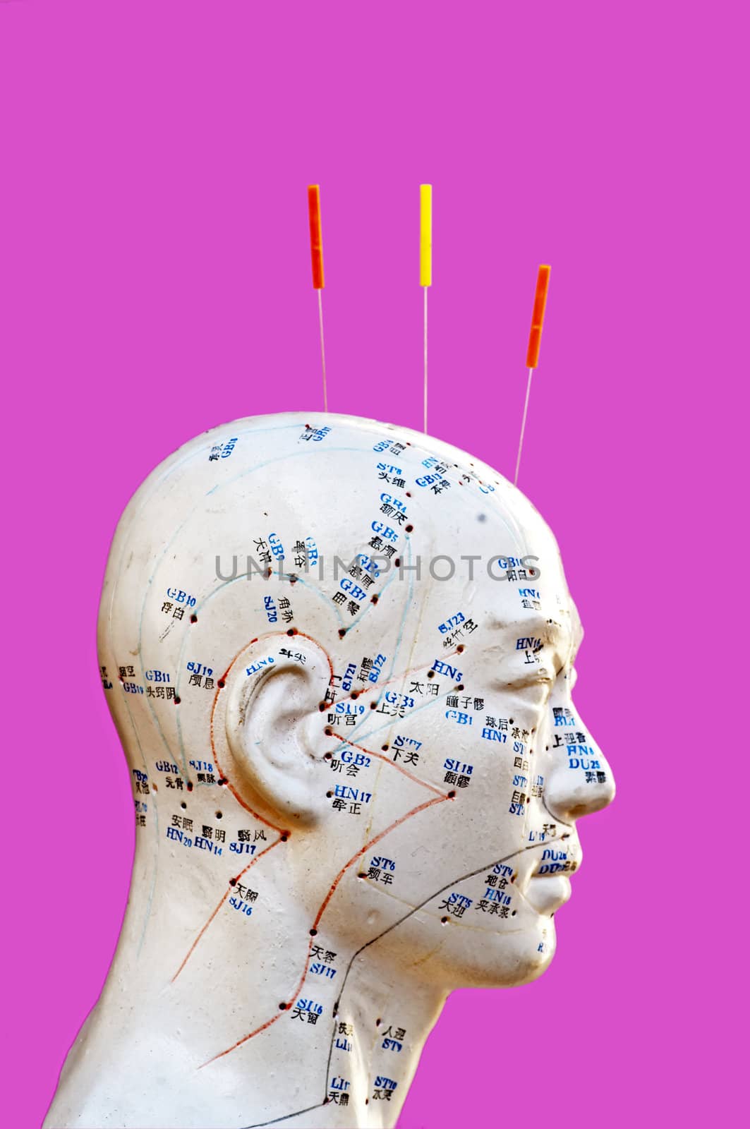 Acupuncture needles on head model by Jochen