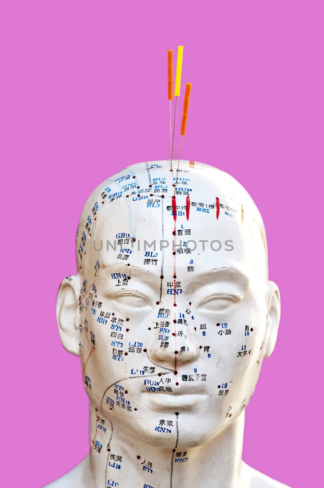 Acupuncture needles on head model by Jochen