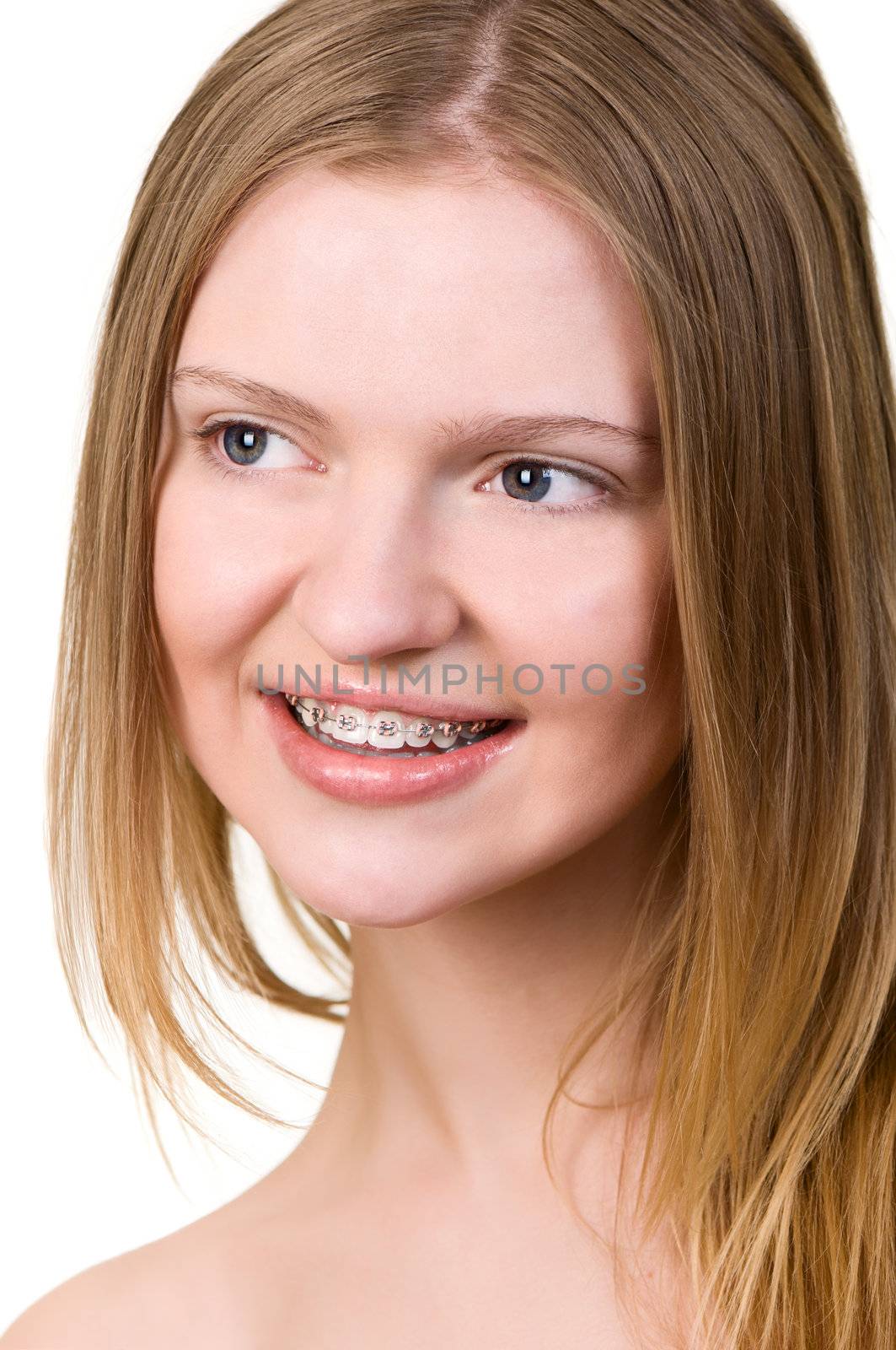 Beautiful young woman with brackets on teeth close up