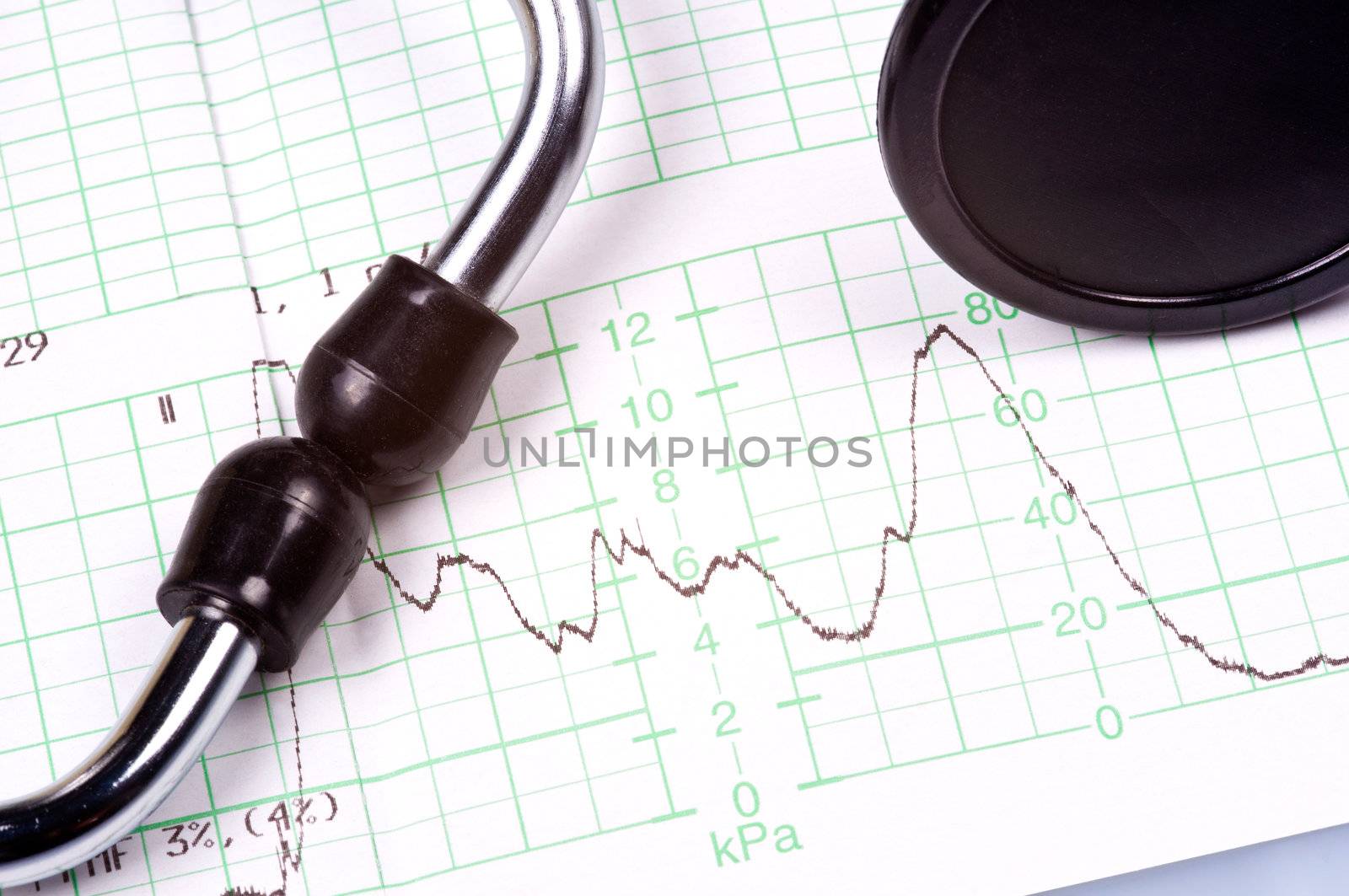 Graph and Stethoscope by ruigsantos