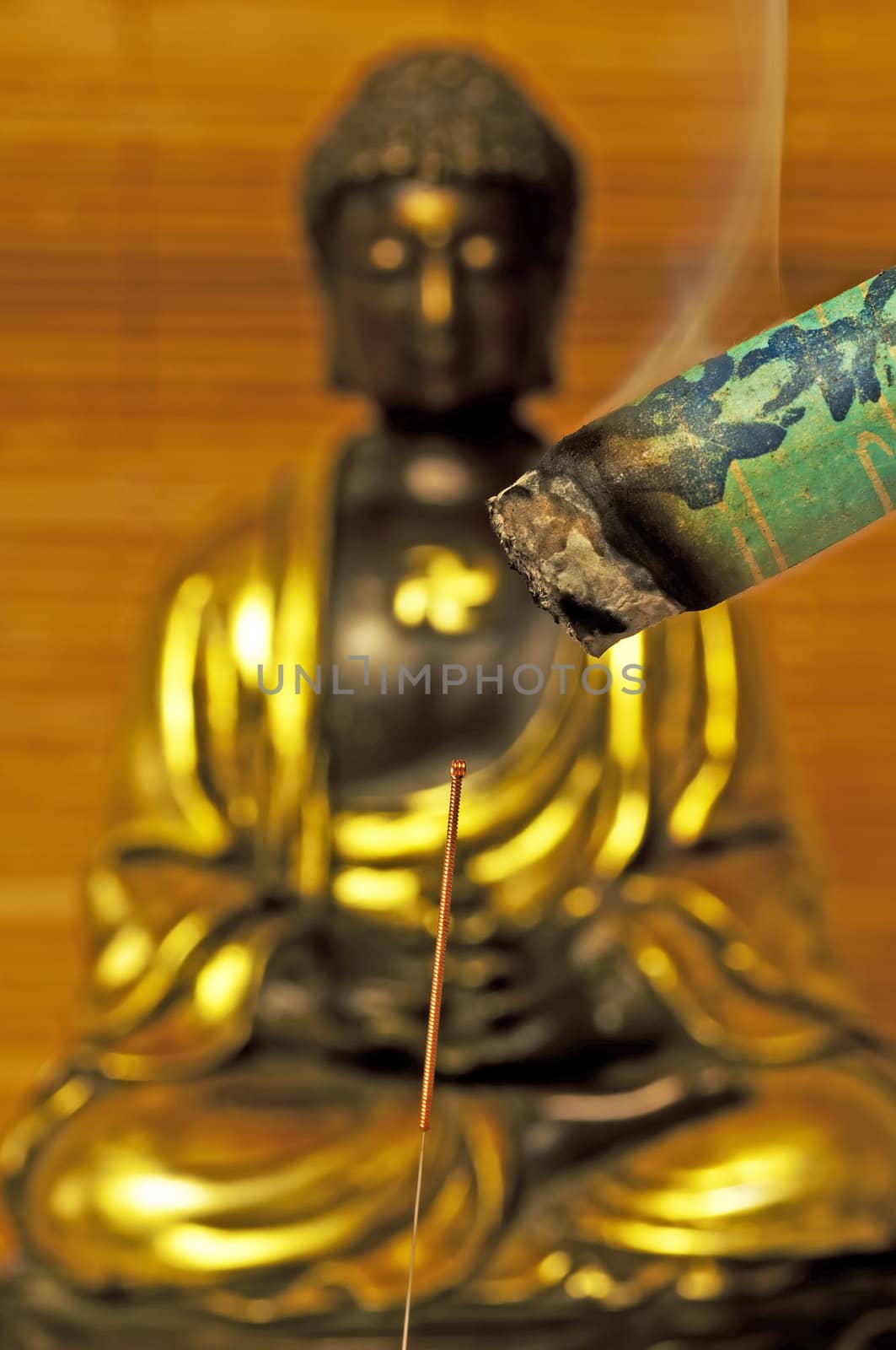 acupuncture needle and moxibustion by Jochen