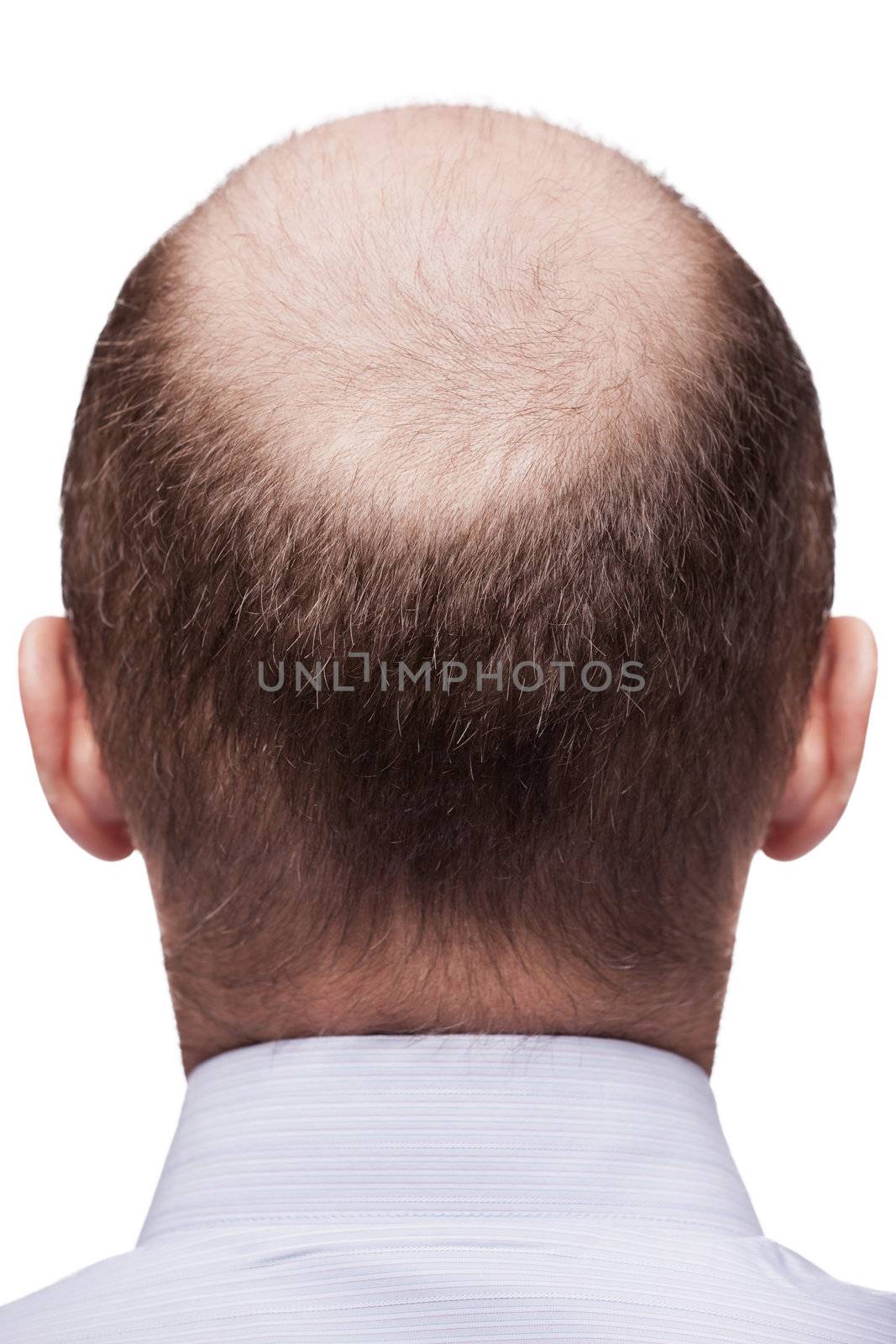 Bald man head by ia_64