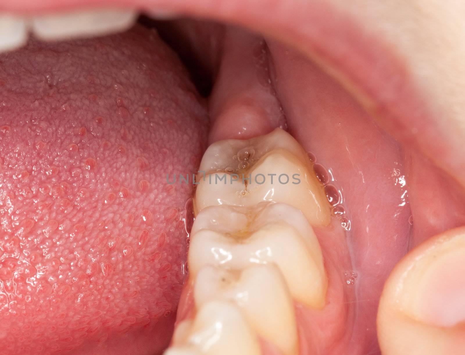Macro image of filled teeth by steheap