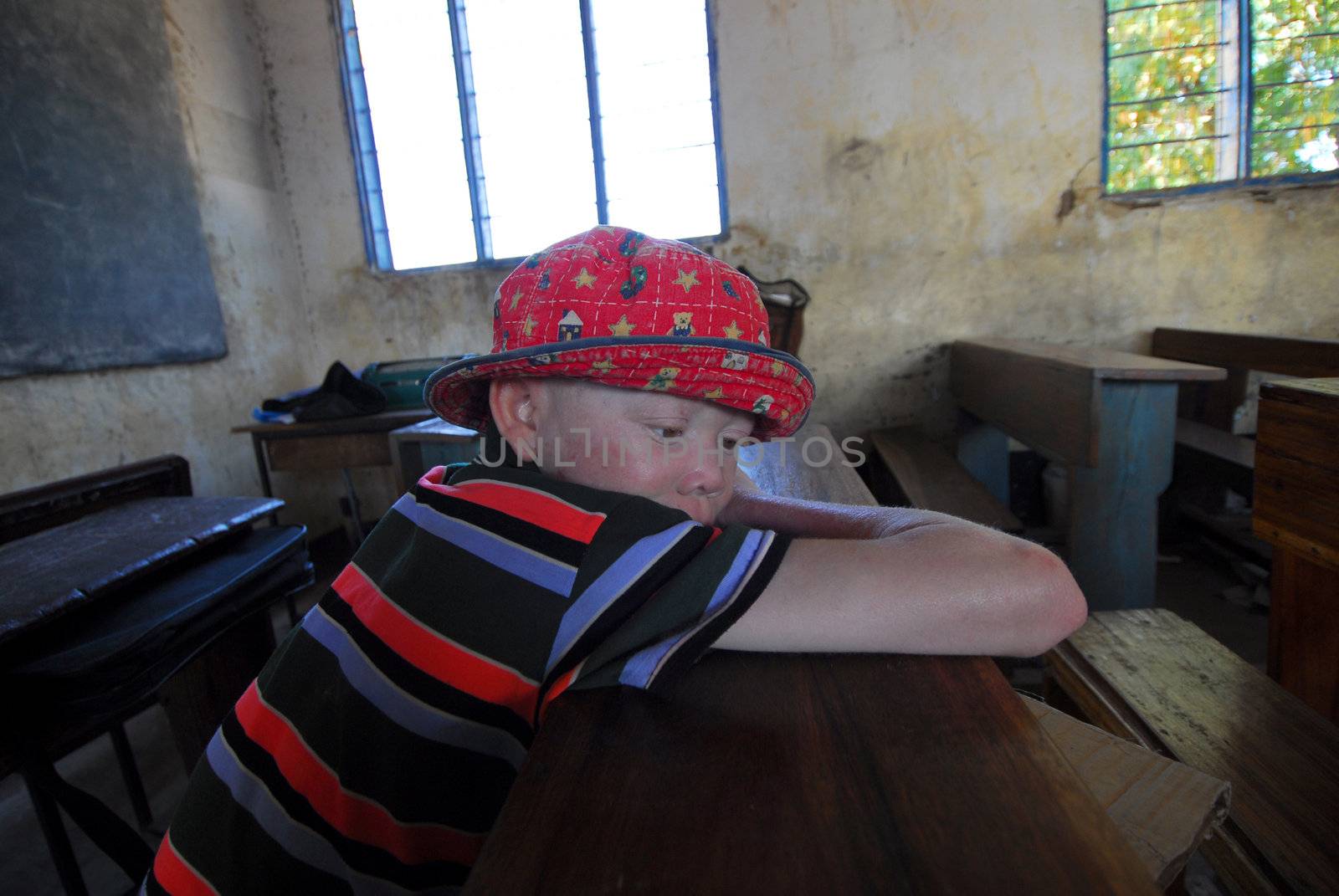 Mwanza, 2010 Tanzania March 25, 2010: 
African albino boy leaning on school desk. Tanzania is the African region with more albinos. By the year 2006
albino people are killed for witchcraft rituals