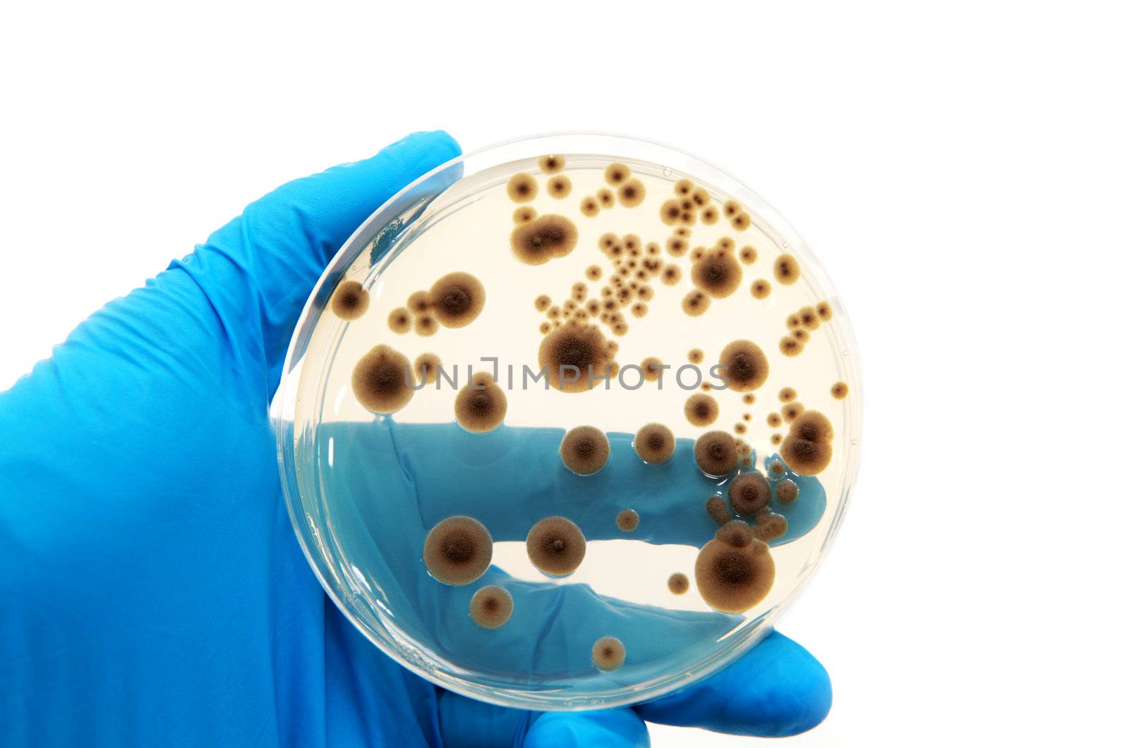 microorganisms on the agar plate by catolla
