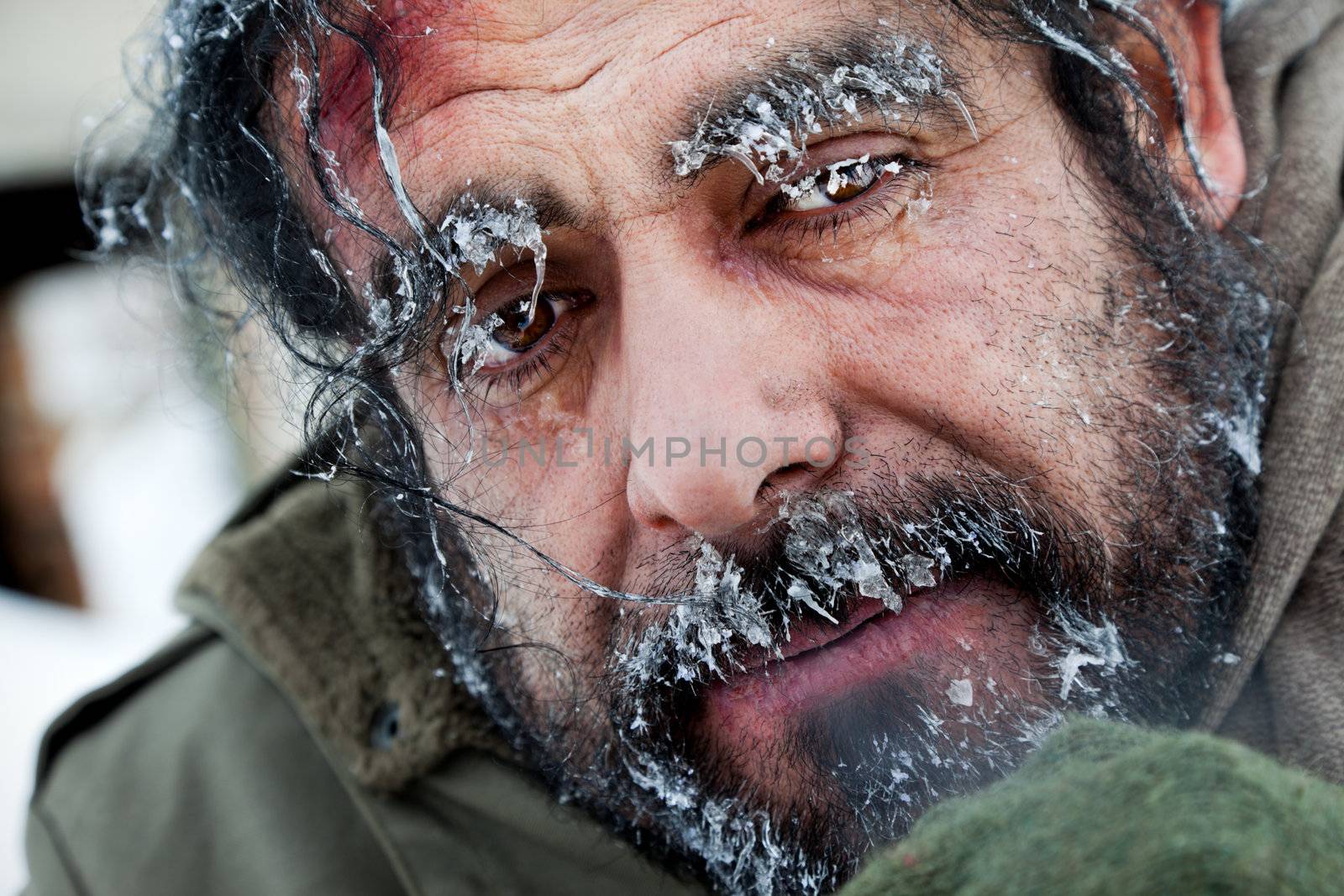 Close-up of homeless male face covered with frost