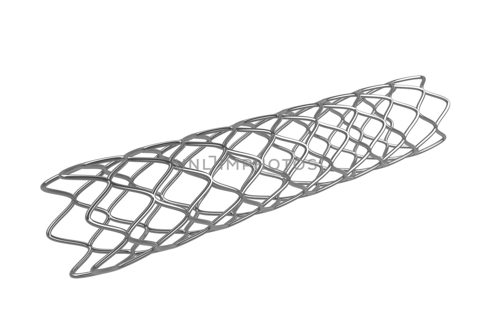 Stent by magraphics