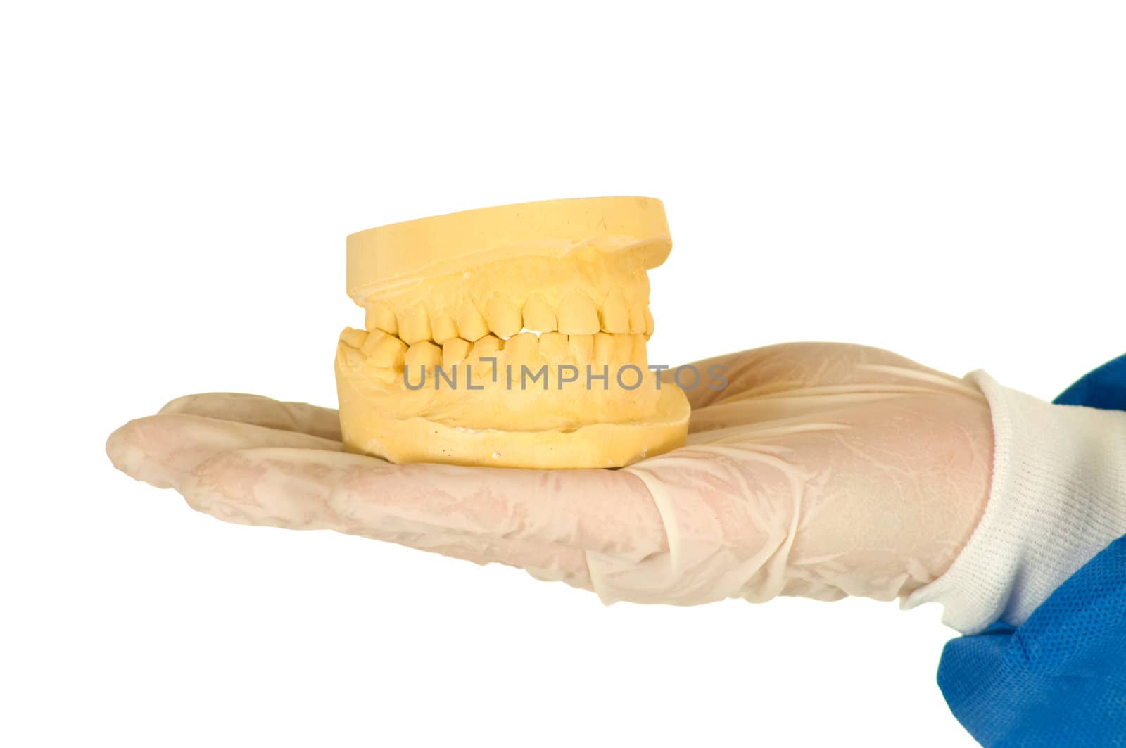 dentist holding a mold of denture by ambro
