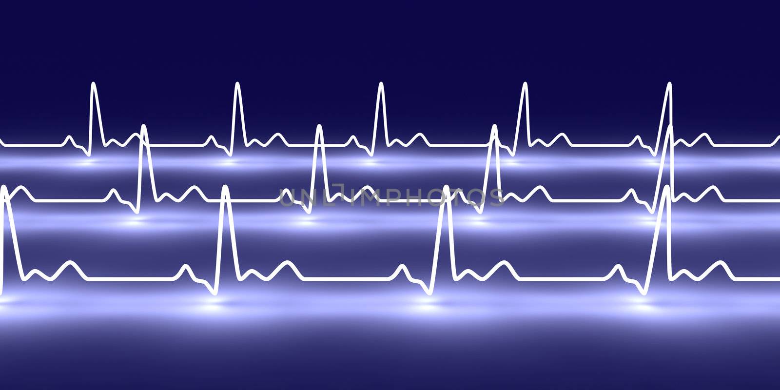 Pulse trace
 by Spectral