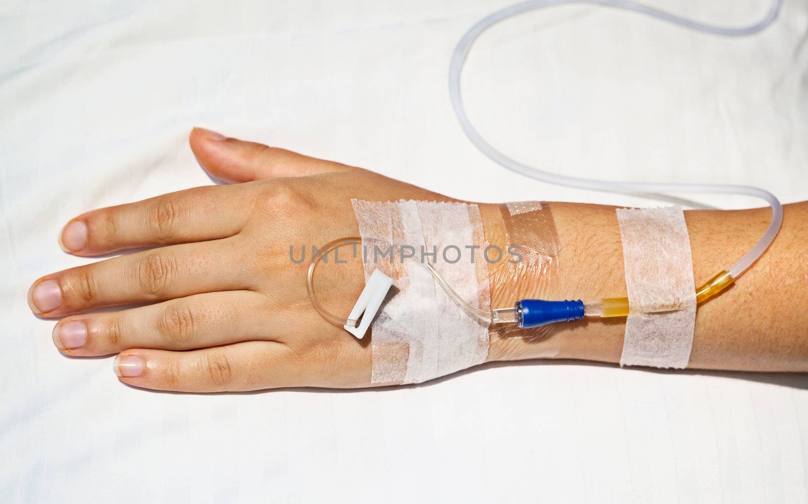 Medical intravenous cannula on hand by pzaxe