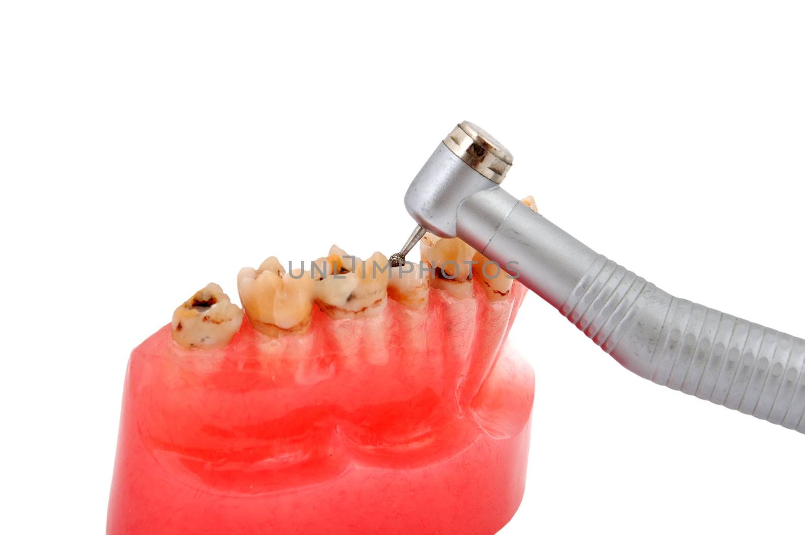 jaw affected tooth decay and dental handpiece
