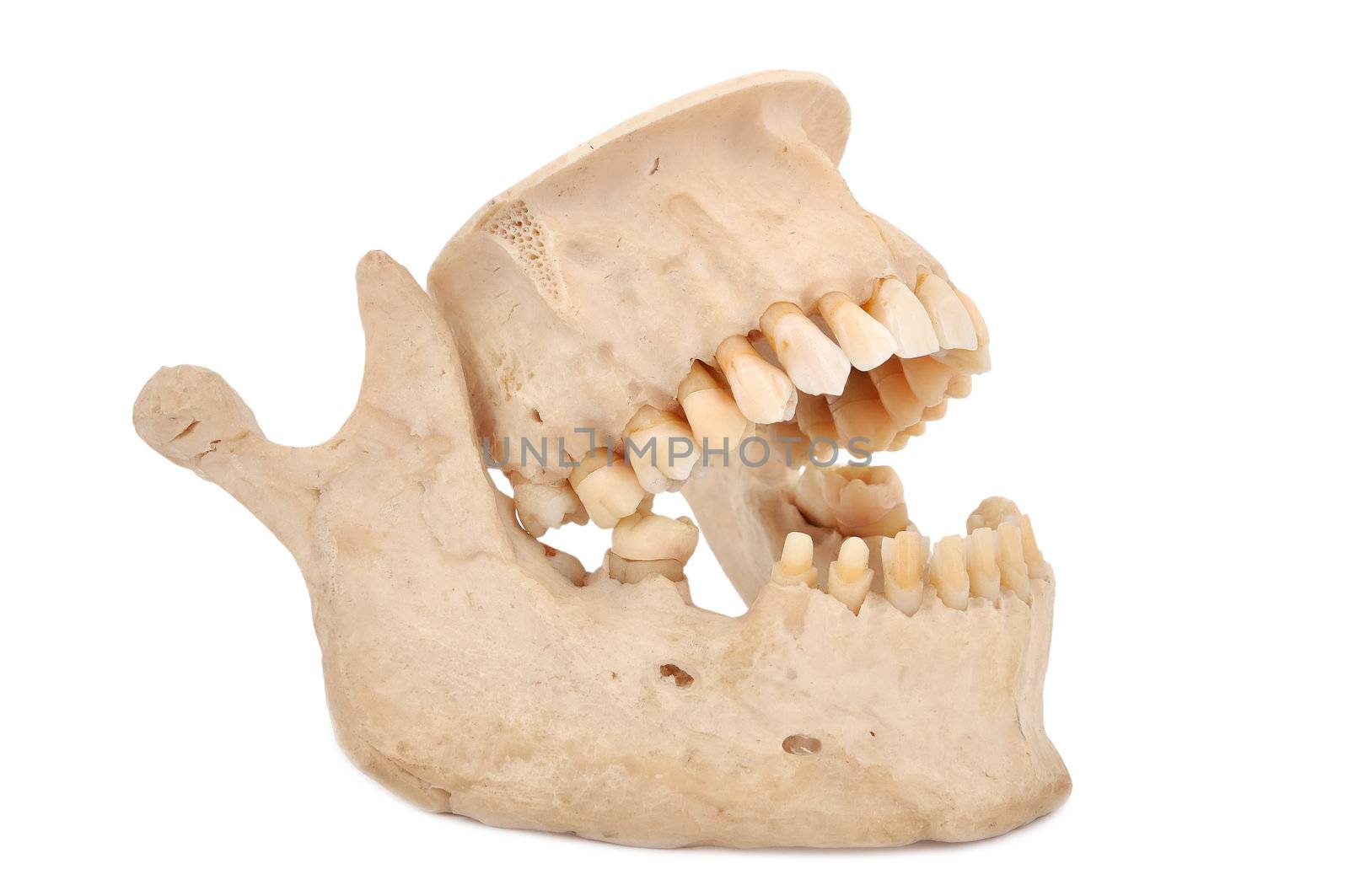 model of human teeth on a white background