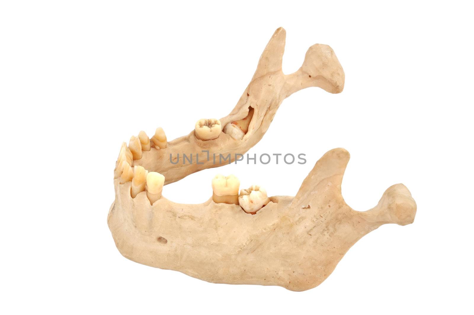 lower human jaw on a white background