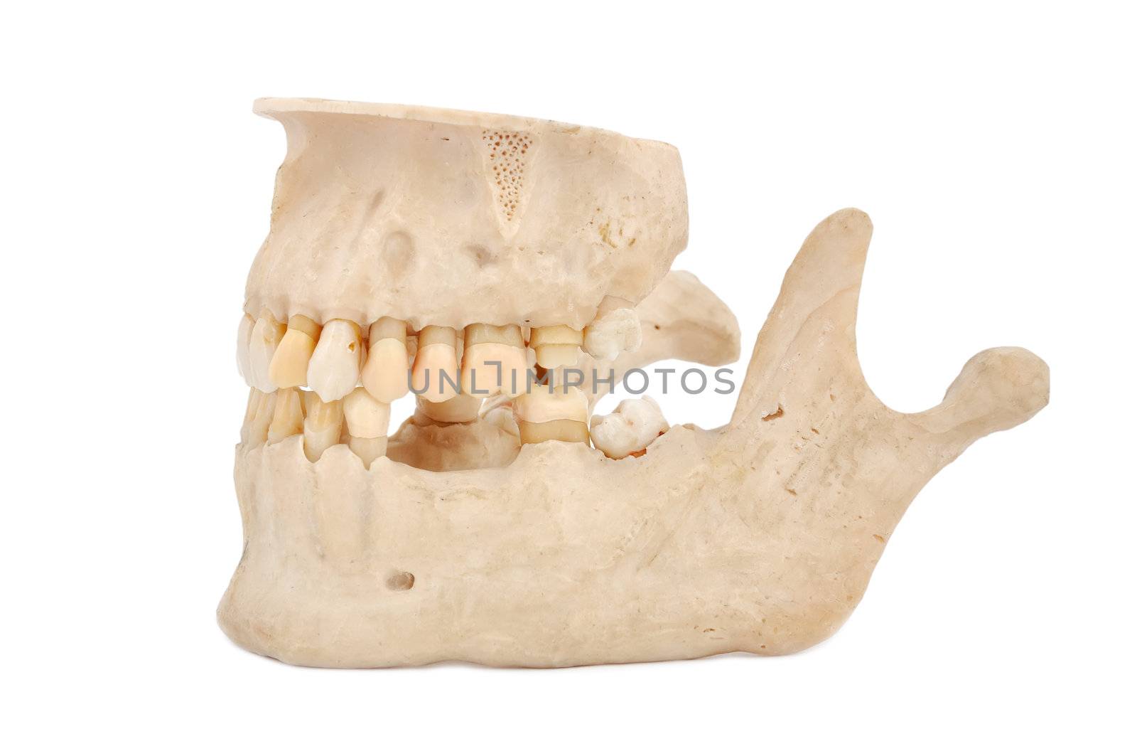 human jaw by vetkit