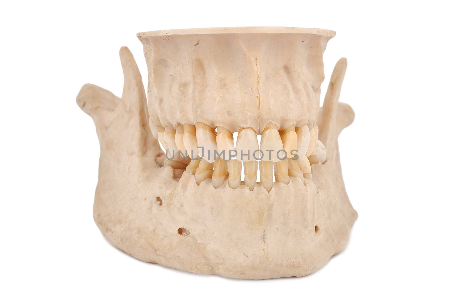 human jaw by vetkit