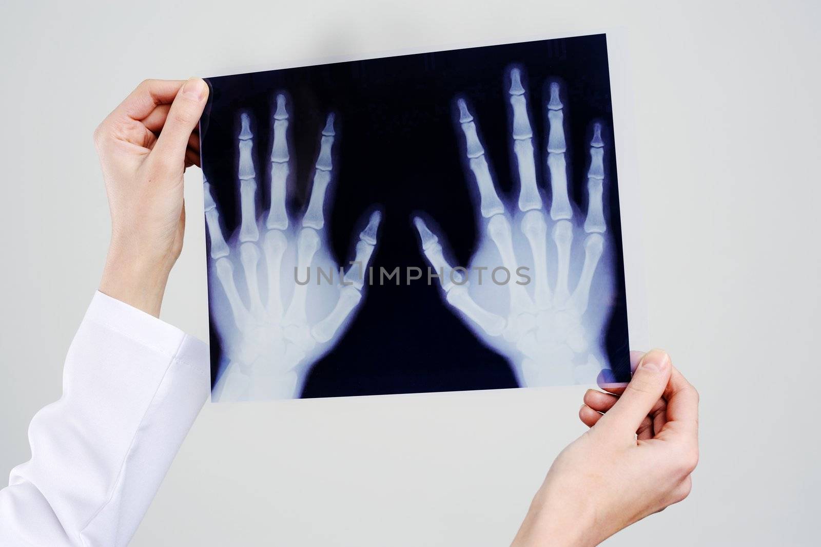 An image of hands holding x-ray