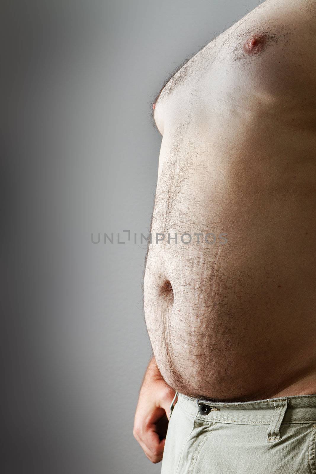 Shows too much food from either too much unhealthy eating , beer belly or just lack of exercise. includes stretch marks and some hair.