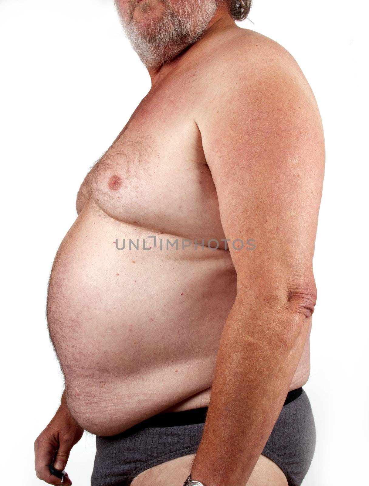 Elderly male body  with obesitas