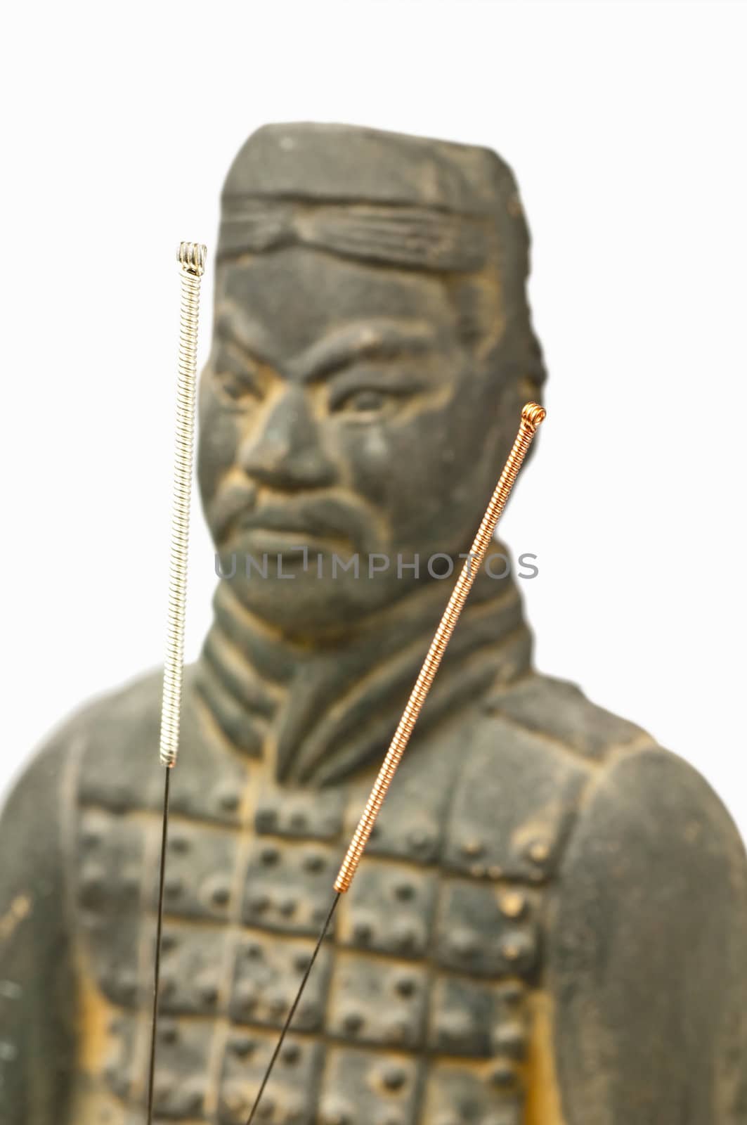 acupuncture needles with chinese antique soldier