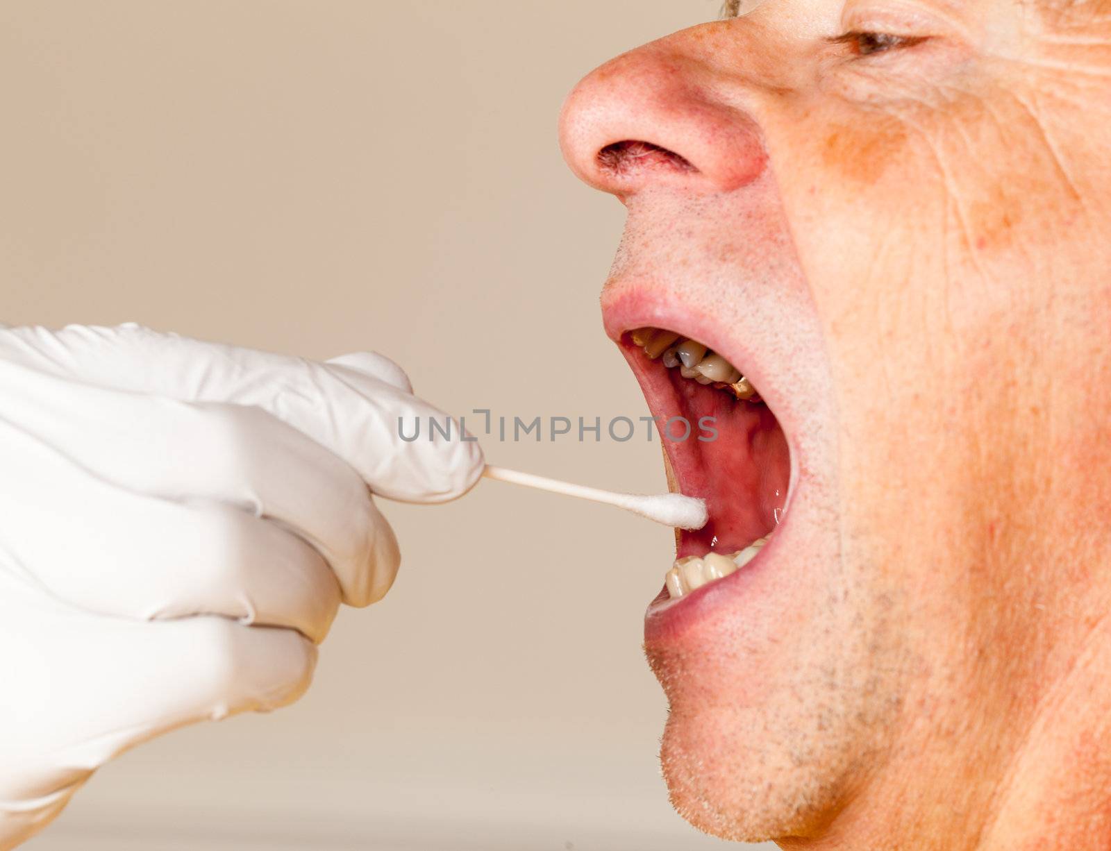 Gloved hand taking a bodily fluid sample for DNA test from senior male person