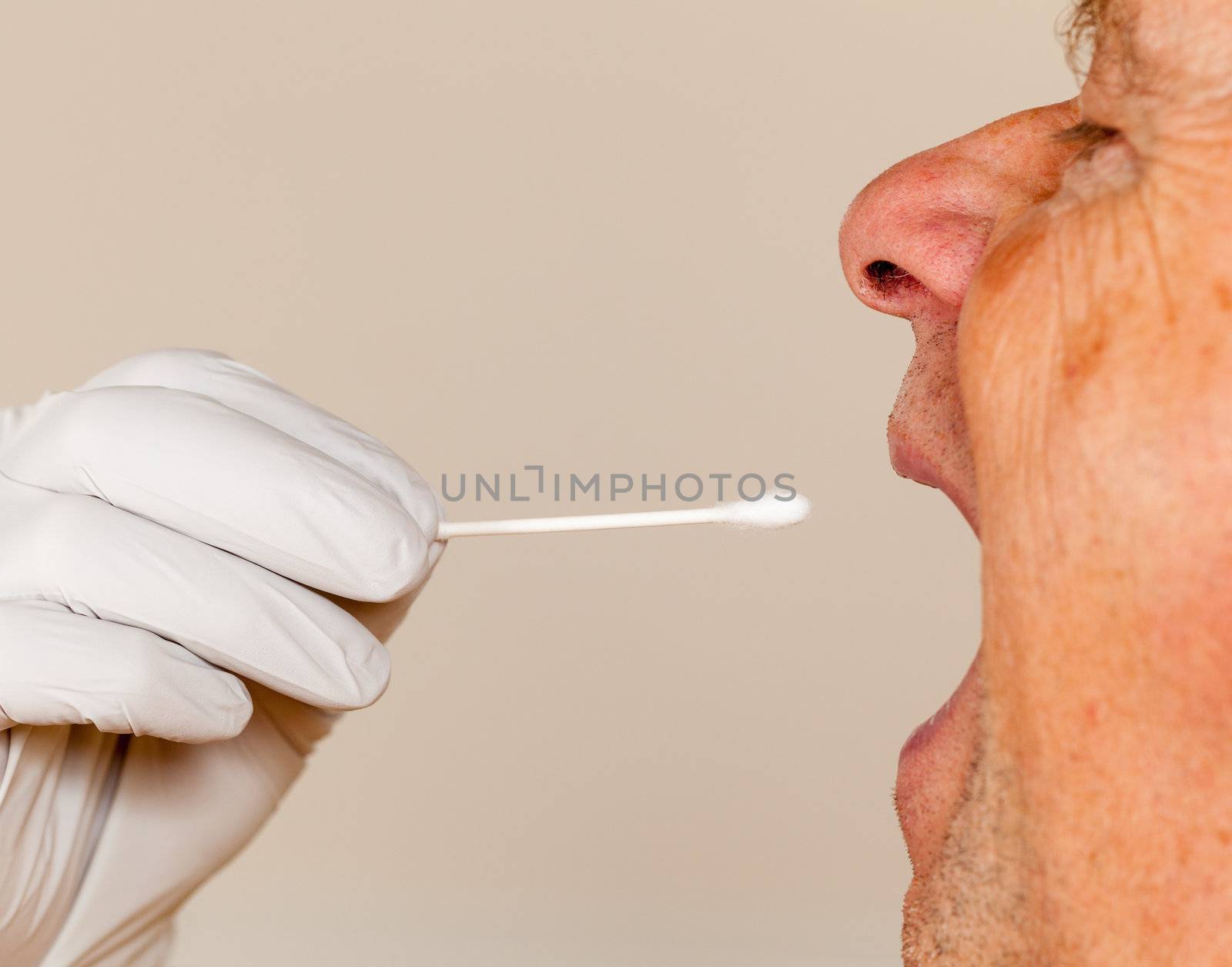 DNA swab of saliva taken from senior man by steheap
