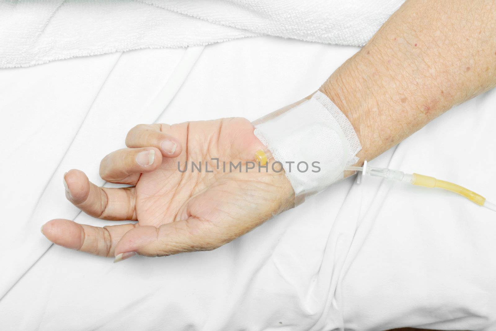 Image of Patient hand with an intravenous drip.