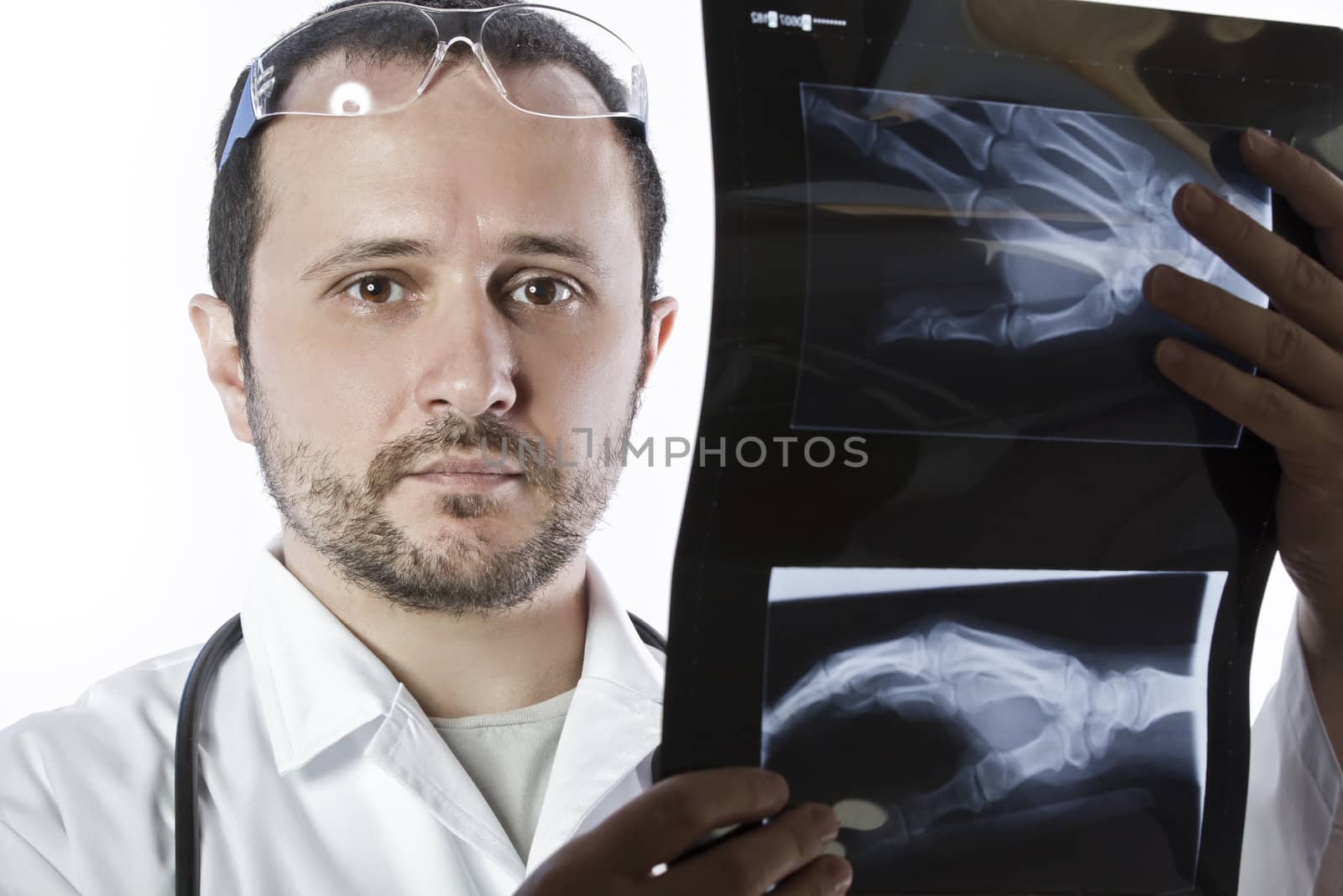 Doctor holding an x-ray appeal of a hand by FernandoCortes