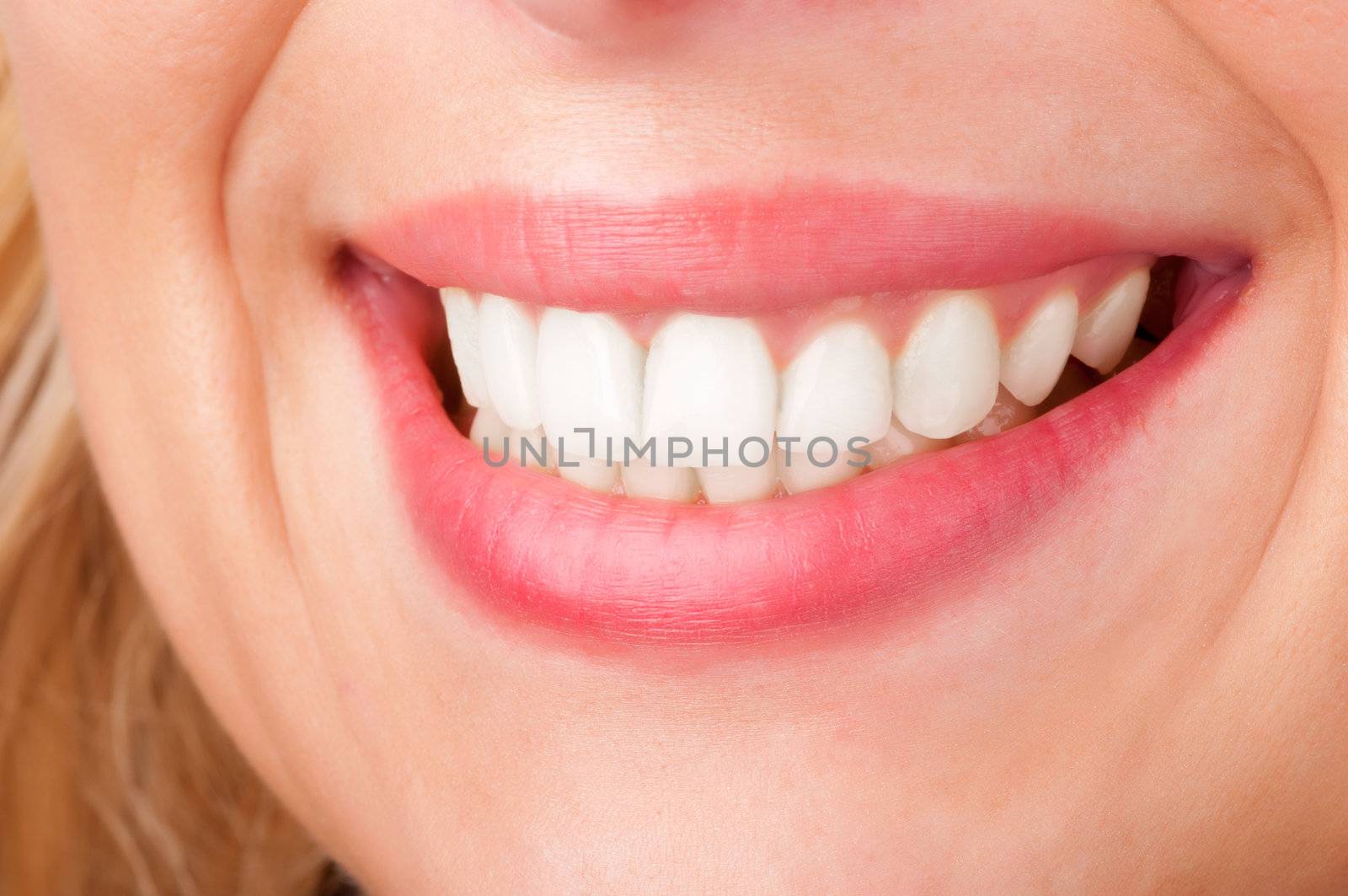 Smiling womans mouth with great white teeths