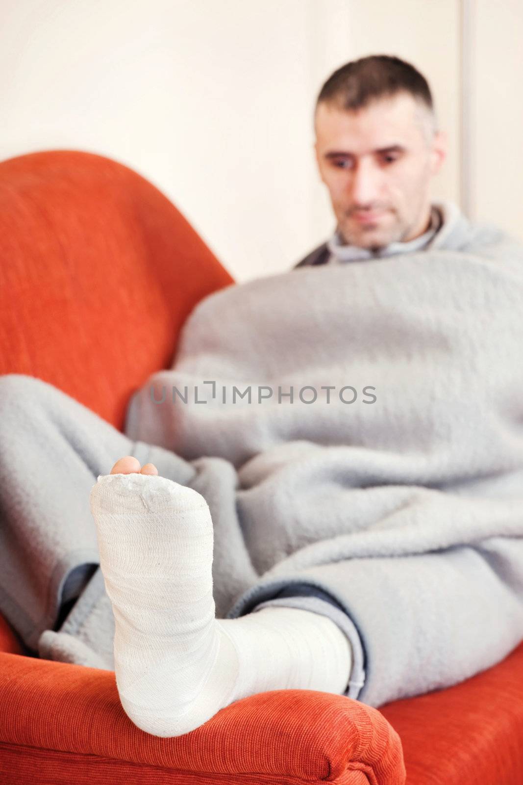 man with a broken leg on a sofa at home