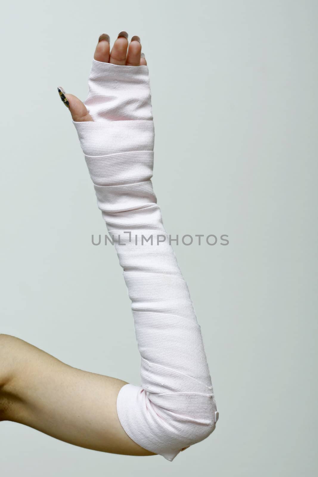 left arm and wrist in thick bandages.