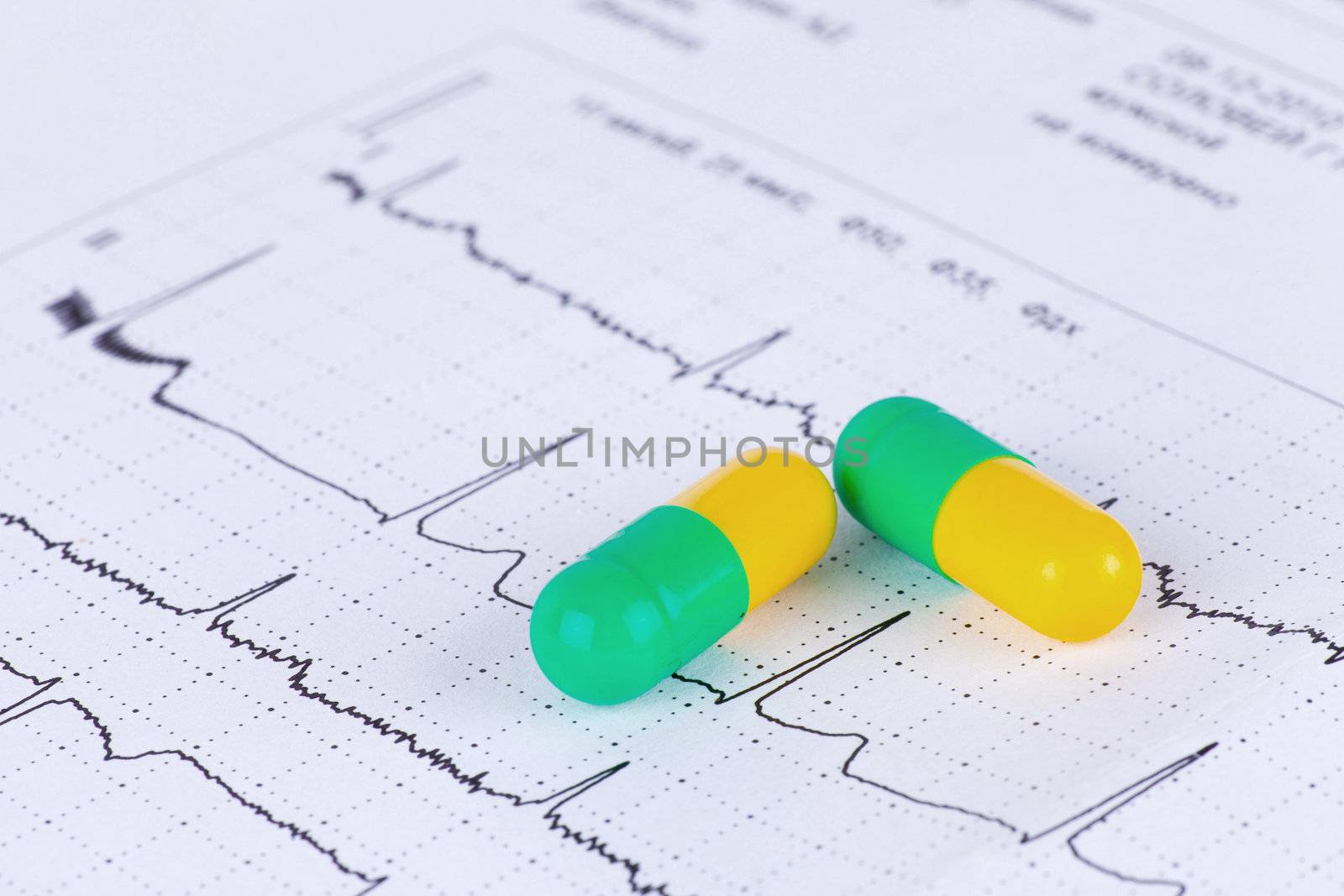 Macro of pills lying on ECG diagram