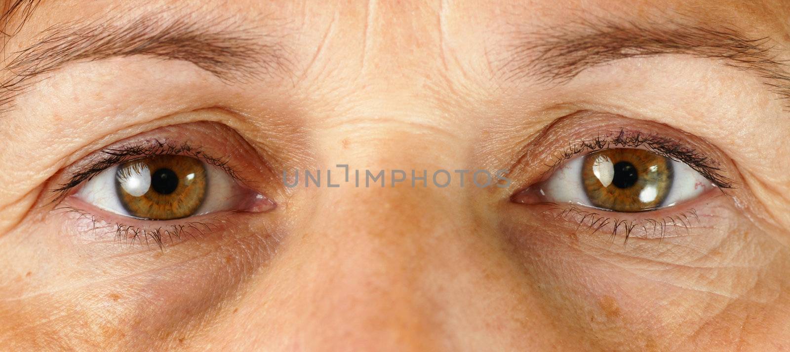 Great detail macro of a very tired or sick middle age woman, with wrinkles, sun damage, veins in the eyes and dark circles under the eyes all showing.